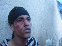 Violente répression à Nouakchott: un policier et plusieurs manifestants bléssés Violente répression à Nouakchott: un policier et plusieurs manifestants bléssés