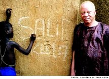 Menacé dans son pays, un Malien albinos obtient le statut de réfugié. La fondation du chanteur malien Salif Keita, lui-même albinos, a soutenu Abdoulaye Coulibaly Menacé dans son pays, un Malien albinos obtient le statut de réfugié. La fondation du chanteur malien Salif Keita, lui-même albinos, a soutenu Abdoulaye Coulibaly