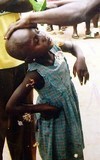 Afrique : le martyre des "enfants sorciers" Afrique : le martyre des "enfants sorciers"