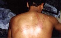 Convention contre la torture : Que signifie le geste de Hamady Ould Hamady à l’ONU ? Convention contre la torture : Que signifie le geste de Hamady Ould Hamady à l’ONU ?