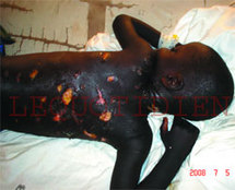 Sénégal- KAOLACK - Un marabout et son adjoint s’acharnent sur un enfant de 7 ans : L’HORREUR ! - Il a été tabassé à mort pour 200 Fcfa