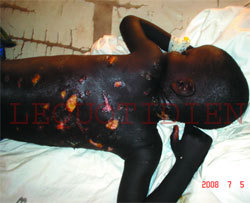 Sénégal- KAOLACK - Un marabout et son adjoint s’acharnent sur un enfant de 7 ans : L’HORREUR ! - Il a été tabassé à mort pour 200 Fcfa