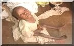 Boghé : 500 Millions d’ouguiyas pour la prise en charge de la malnutrition.