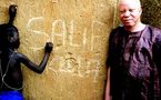 Menacé dans son pays, un Malien albinos obtient le statut de réfugié.  La fondation du chanteur malien Salif Keita, lui-même albinos, a soutenu Abdoulaye Coulibaly