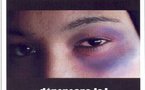 25 novembre : Journée Internationale pour l'élimination de la violences à l'égard des femmes
